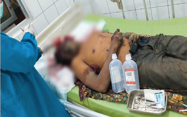 Adik Pukuli Kakak Kandung Pakai Balok Hingga Masuk Rumah Sakit