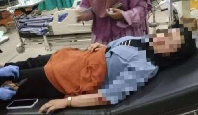 Korban penjambretan di Jalan Caman Sampit Kotawaringin Timur Jumat 7 Oktober 2022