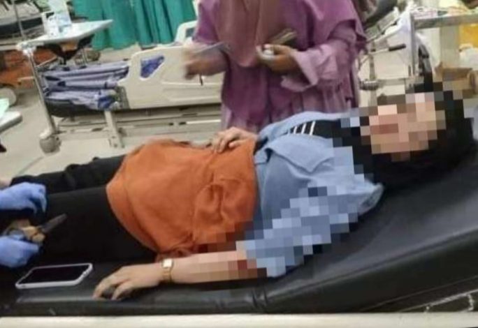 Mahasiswi Korban Penjambretan Mengalami Luka Lecet di Wajah