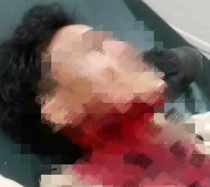 Pemuda Ditusuk Pisau Pasca Makan di Warung Makan