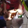Jari Seorang Bocah di Sampit Terjepit Cincin Teropong Mainan Sampai Bengkak