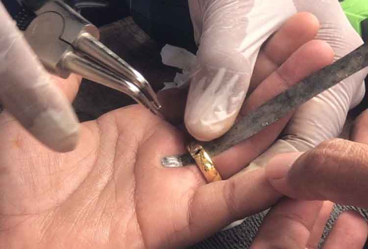 Bikin Deg-degan! Petugas Damkar Kotim Berhasil Lepaskan Cincin Tersangkut di Jari Wanita